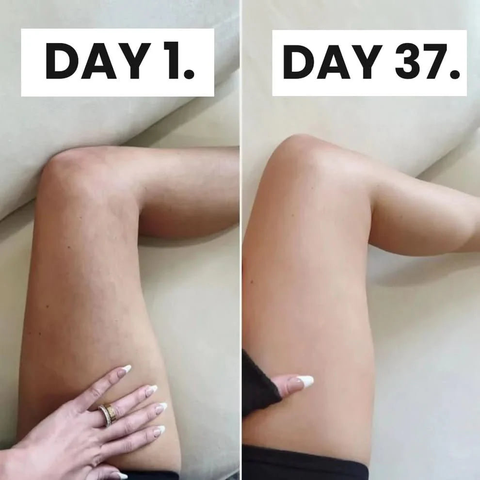 Cellulite Transformation System